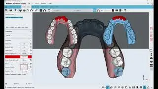 Maestro 3D | Dental Studio Expert | Model Builder - What's new in Maestro 3D Expert