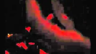 11.3.11 - Traumpunkt with Marc Lansley  (Levontin 7, Tel Aviv)