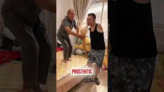 He Lost Both Hands&hellip; And His Sick Dad Still Helps Him Every Day 💔
