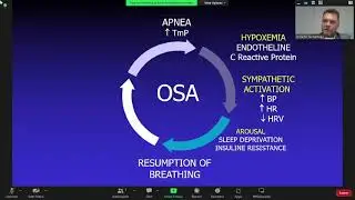 Síndrome de apnea obstructiva y complicaciones cardiovasculares