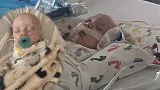 &lsquo;Definitely the scariest&rsquo;: RSV puts babies in ICU