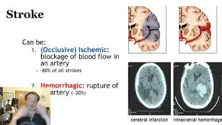 Aphasia & TBI