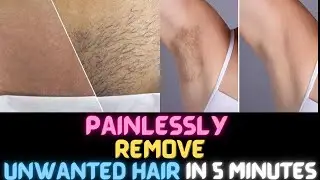 In 5 Minutes Remove Unwanted Hair Permanently 🥵NO SHAVE NO WAX,Painlessly Remove Unwanted Hair 😱 💯%