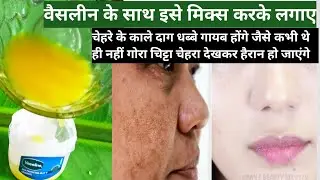 चेहरे पर वैसलीन का सही इस्तेमाल आपके चेहरे के काले दाग धब्बों को दूर करेगा/ Vaseline benefit