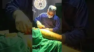 hip fracture#bipolar hemiarthroplasty#fracture#trauma#surgery