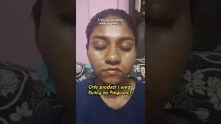 My skin brightening serum for hyperpigmentation! 🤯🚨✨️ #beforeandafter #kumkumadi #skincare #shorts