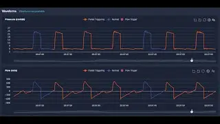 Failed Triggering Breath (Ineffective effort) because of ventilator over assistance