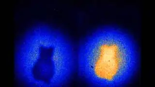 Quantum entanglement imaging