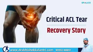 ACL Injury Recovery | one more Patient Experience after Surgery