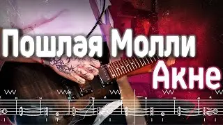Как играть Пошлая Молли - Акне | кавер + табы | Разбор на гитаре