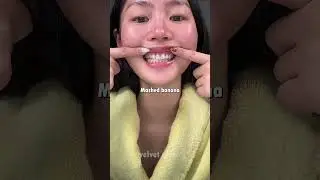 Her Teeth Look Professionally Whitened... But It&rsquo;s DIY 👀💎