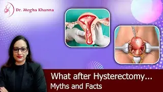 Hysterectomy Myths vs Facts | Recovery, Diet & What to Expect After Surgery