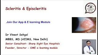 Scleritis & Episcleritis II Causes- Red Eye