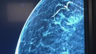 Can men also get breast cancer?