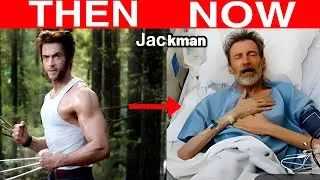 x men cast, x men cast then and now, x men actors now
