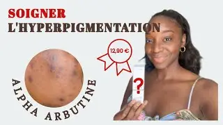 SOIN DU VISAGE - Soigner l'hyperpigmentation/tâches brunes : The ordinary