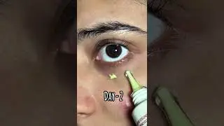 Korean eye creams just wow #skincare #kbeauty #skincareroutine