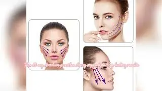 🎥 4D COG Thread Lift &ndash; Instant Face Lift WITHOUT Surgery! 🤯