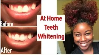 How I Whitened My Teeth At Home | Smile Brilliant
