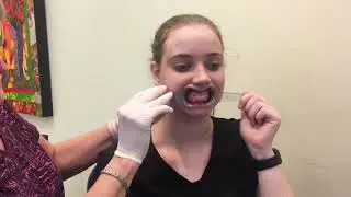 Taking full series orthodontic photos