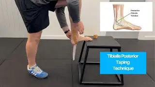 Tibialis Posterior Taping Technique | Support for Flat Feet, Shin Splints & Foot Pain