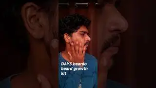 DAY5 beardo beard growth kit #beardo #beard #jasonmomoa #masculinity #mensfashion