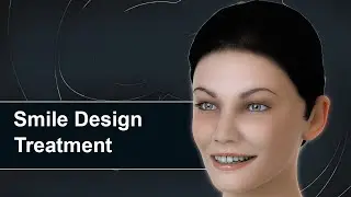 УДИВИТЕЛЬНАЯ 3D-анимация для дизайна улыбки | Косметическая стоматология