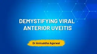 Demystifying viral anterior Uveitis - Dr Aniruddha Agarwal