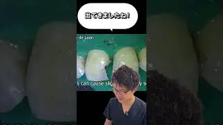 前歯の虫歯治療について解説！#虫歯 #歯医者