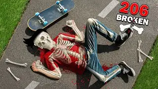 Breaking More BONES Using Skate Board 💀