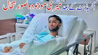 After the Accident: My Recovery Journey & Who Came to See Me 