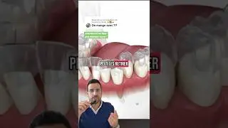 Orthodontie invisible : comment fonctionnent les goutti&egrave;res transparentes ? 🦷🫧