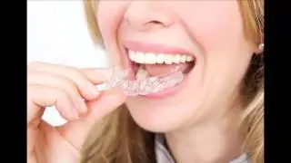 Elegant Smile Dental : Invisible Braces in Beverly Hills