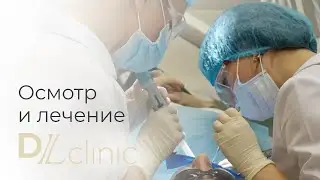 Осмотр и лечение зубов в DLclinic