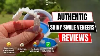 I Tried Shiny Smile Veneers at Home &ndash; Easy Process or Hard Work?