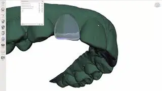 MeshMixer - Single Tray Ortho Correction