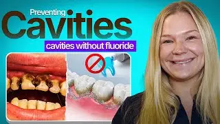✨ Prevent Cavities Without Fluoride! | Hygienist Heather