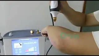 2 in 1 Plasma Pen Ozone Plasma Skin Rejuvenation Machine R38 Operation Video