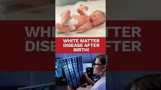 Birth Injury Warning: &ldquo;White Matter Disease&rdquo; Could Mean Brain Damage