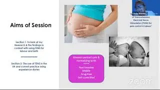 TensCare Webinar:TENS for labour and birth