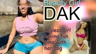 DAK amputee girl with her DOG