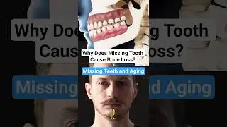 Why Does Missing Tooth Cause Bone Loss? | Missing Teeth and Aging