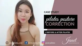 Pilates Before and After - Case Study Body Posture Correction