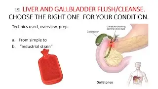 LIVER/GALLBLADDER CLEANSE/FLUSH. HOW TO DO LIVER CLEANSE. TECHNIQUES. WHICH IS THE BEST FOR ME?