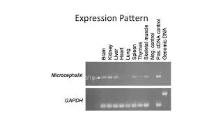 Genetics of human brain size evolution
