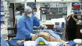 Tickle Lipo - Physician Body Solutions in Philadelphia