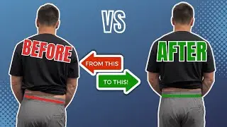 Fix Your Uneven Hips FAST: Stretch & Strengthen for Better Alignment