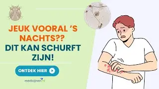 Heb jij schurft? Zo raak je het kwijt