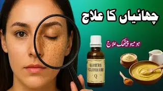  چھائیوں کا علاج| Chaiyon Ka Ilaj | Freckles Treatments | chahray saf or gora karain | 