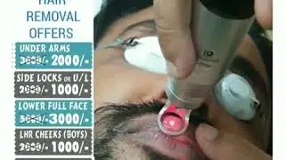 Laser Lip Lightening